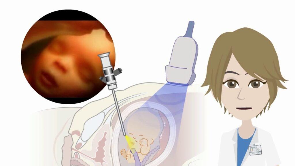 Análisis de diagnóstico genético prenatal